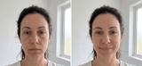 Avant apres : visage degonfle en 2 minutes