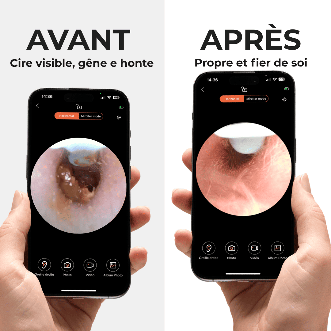 Lumea Vision 1.0 - Luméa Swiss - Québec